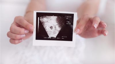 Gynekolog, Tidlig ultralyd eller ultralyd senere i svangerskapet hos Medicus Trondheim